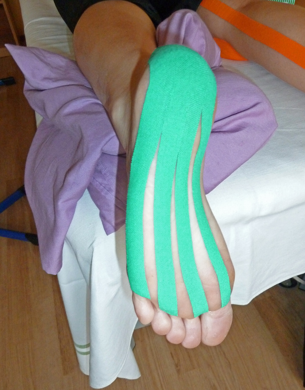 Ukázka tejpingu